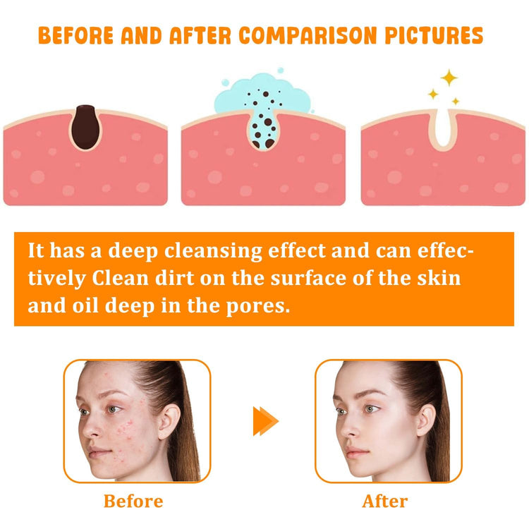 Turmeric Facial Cleanser, Turmeric Facial Wash, Turmeric Face Wash, Turmeric Facial Cleanser,Turmeric Foaming Cleanser for All Skin3.38 Oz